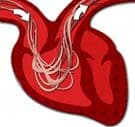 Heartworm Disease in Cats